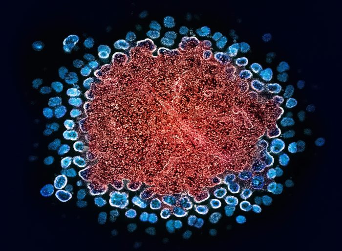 germs